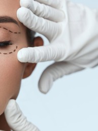 Blefaroplastia: Um novo rejuvenescimento nas pálpebras