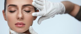 Blefaroplastia: Um novo rejuvenescimento nas pálpebras