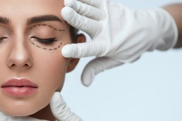 Blefaroplastia: Um novo rejuvenescimento nas pálpebras