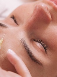 BOTOX: Saiba os benefícios da toxina botulínica