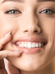 Faceta dental em resina: o que é? Para quem é indicado?