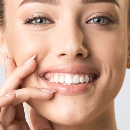 Faceta dental em resina: o que é? Para quem é indicado?