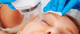 Laser CO2 para a Face: Rejuvenescimento Eficiente e Versátil