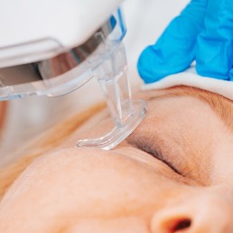 Laser CO2 para a Face: Rejuvenescimento Eficiente e Versátil